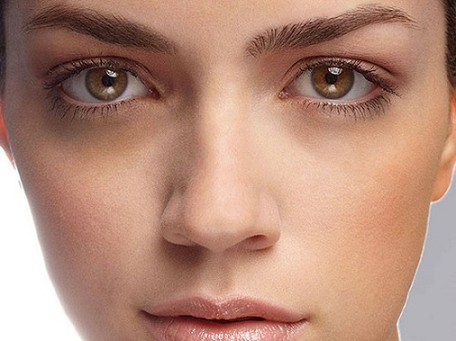 Thâm quầng mắt có mang yếu tố di truyền