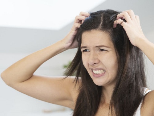 Viêm nang lông là nguyên nhân khiến da đầu ngứa tóc rụng nhiều