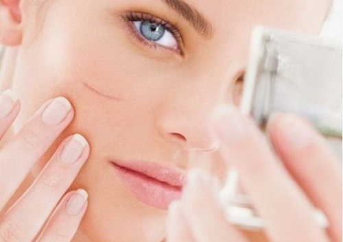 Vitamin E có tác dụng làm mờ sẹo da mặt