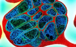 7 loại vi khuẩn kháng thuốc nguy hiểm