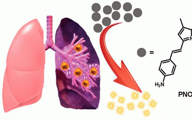Các nhà khoa học tìm ra cách phát hiện sớm bệnh xơ phổi