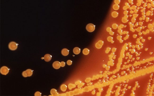 CDC cảnh báo về siêu khuẩn kháng thuốc khiến 4 người chết mỗi giờ