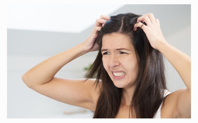 Da đầu bị nổi mụn: Nguyên nhân và cách chăm sóc