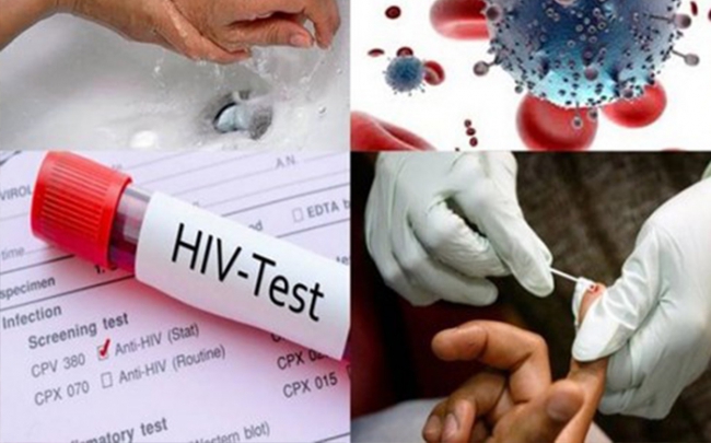 Khi nào cần điều trị dự phòng phơi nhiễm HIV và điều trị như thế nào?