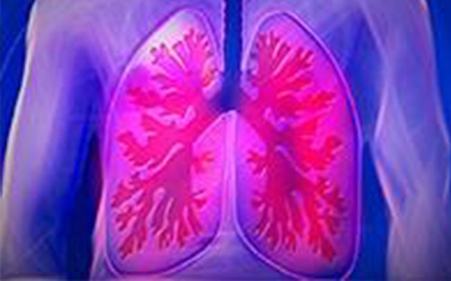 Phát hiện tác dụng chống ung thư phổi của fullerene