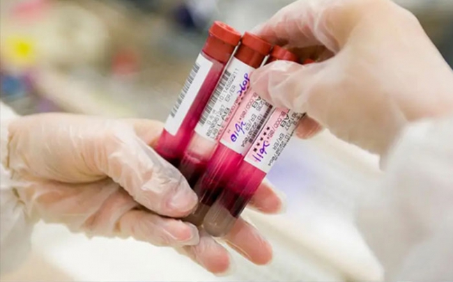 Xét nghiệm máu phát hiện hàng chục bệnh ung thư